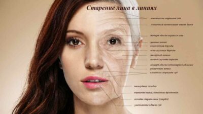 Морщины на лице: какие бывают, почему появляются и что реально помогает